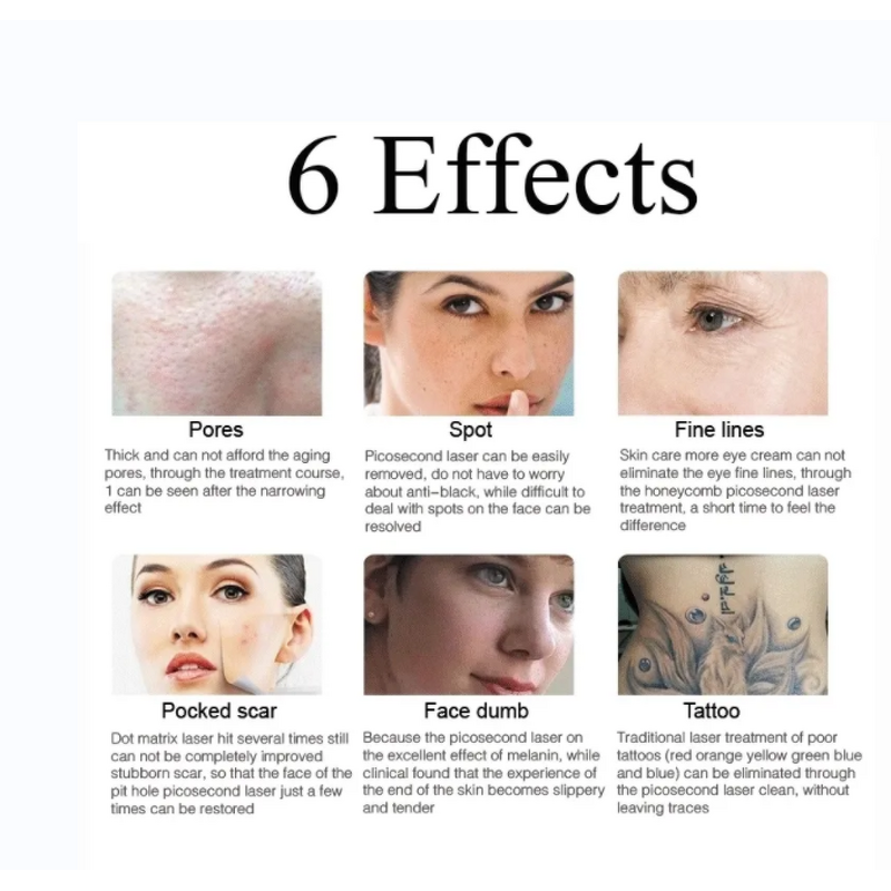 Q Switch Picosecond Laser - 1320 1064 532 755nm Wavelength Tattoo Removal