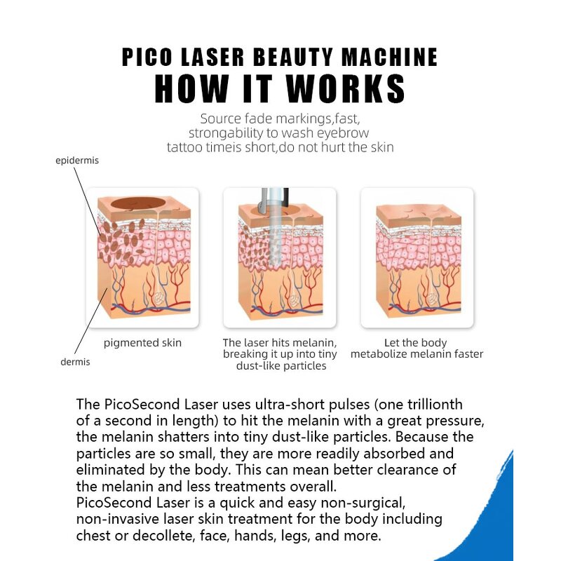 ADG PHT55 Pico Laser - 2500W 1064 755 532nm Spot Eyeline Pigment Removal