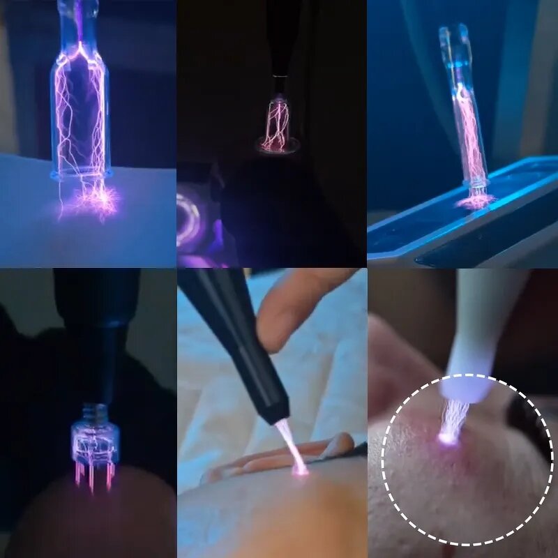 ADG Plasma Ozone Machine - Desktop Anti-Aging Deep Repair Wrinkle Removal AU Face