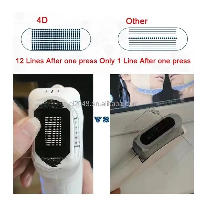 4D Smas Lifting Machine - Portable Skin Tightening Face Lift Anti-Aging Device