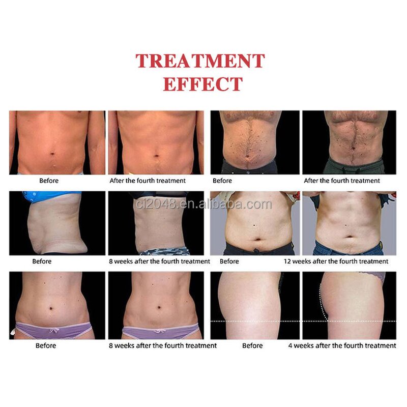 Hiemt Pro Max Machine - Portable EMS Body Sculpting Neo with Pelvic Repair