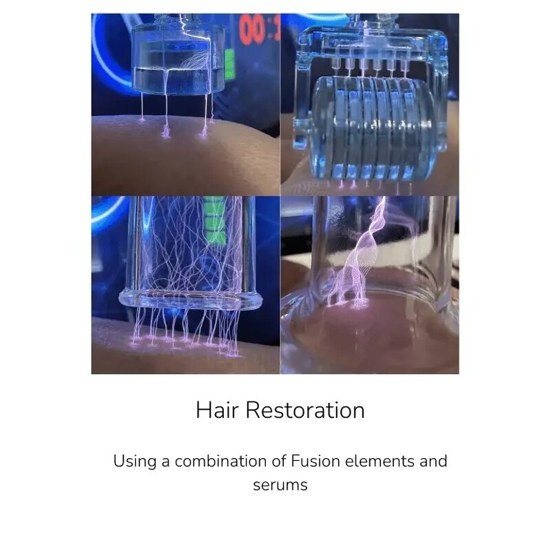 ADG Cold Plasma Pen - Portable Salon Scar Mole Removal Fractional Hot Plasma Jet CN