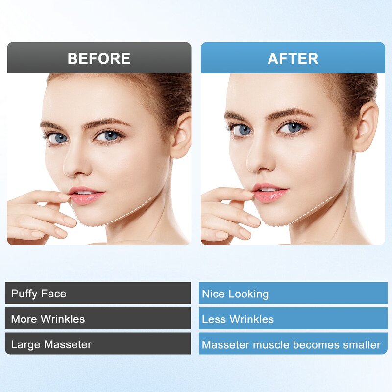 Beauty Device Manufacturer - Factory Sale EMS Red Blue Light Skin Rejuvenation Vibration Anti-Wrinkle V Face