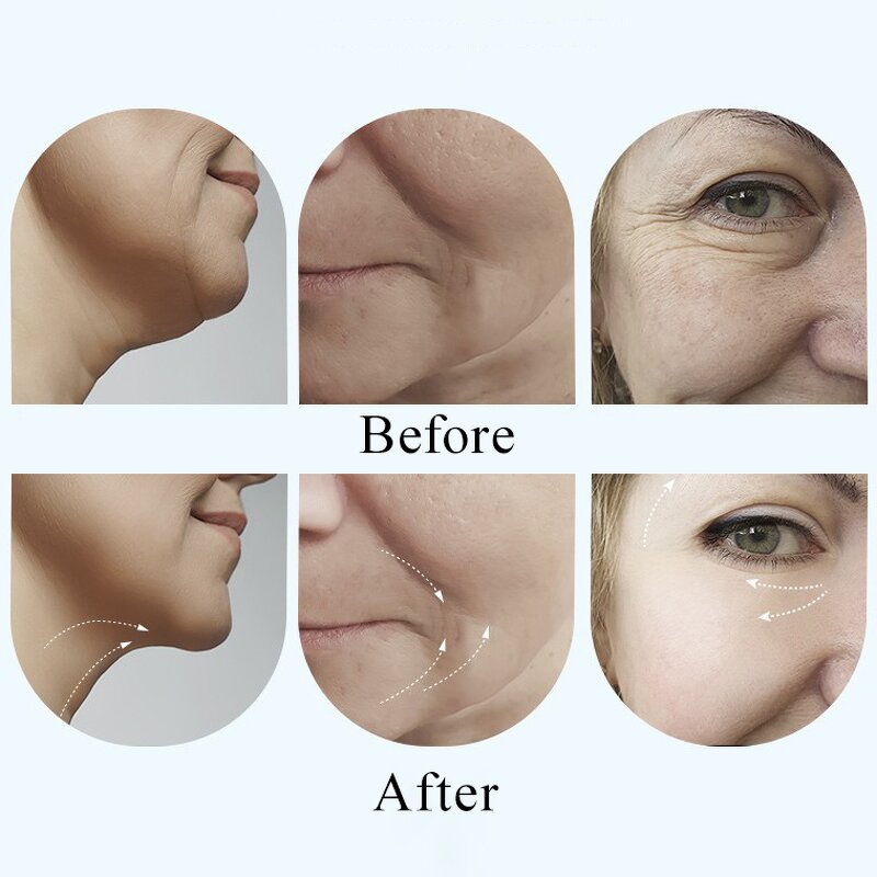 Facial Sculpting Machine Manufacturer - Customized EMS Vibration LED Red Light Therapy Neck Care Skin Tightening