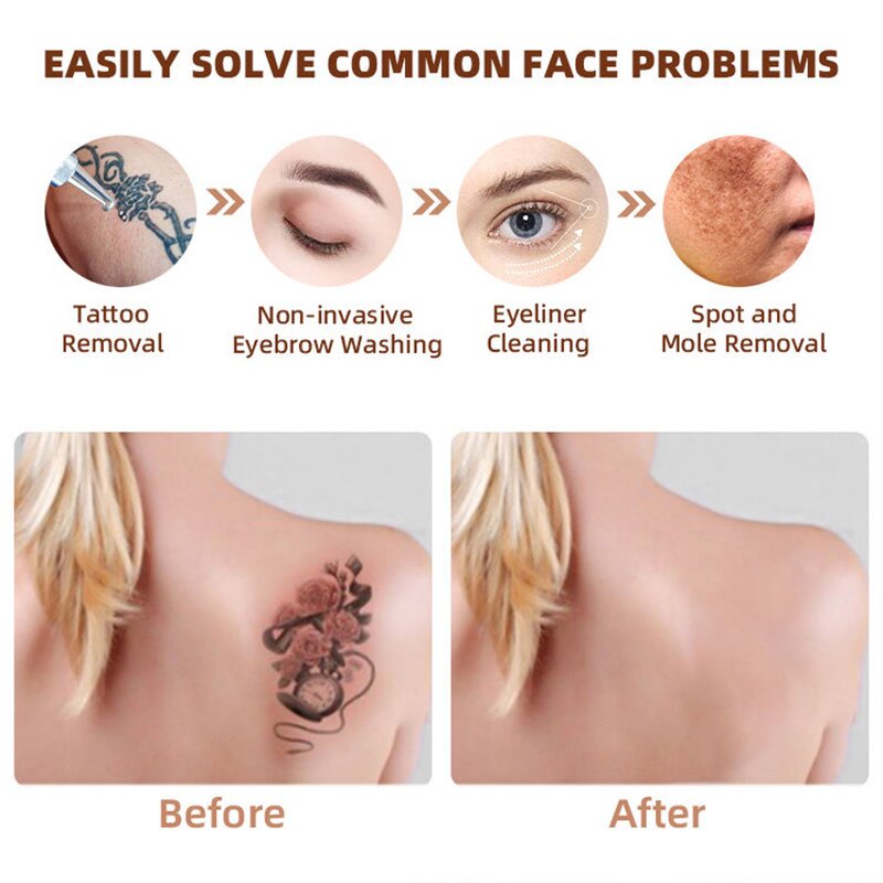 Mini Nd Yag Laser - Second Gen No Water Eyebrow Washing Carbon Peeling Tattoo Tool