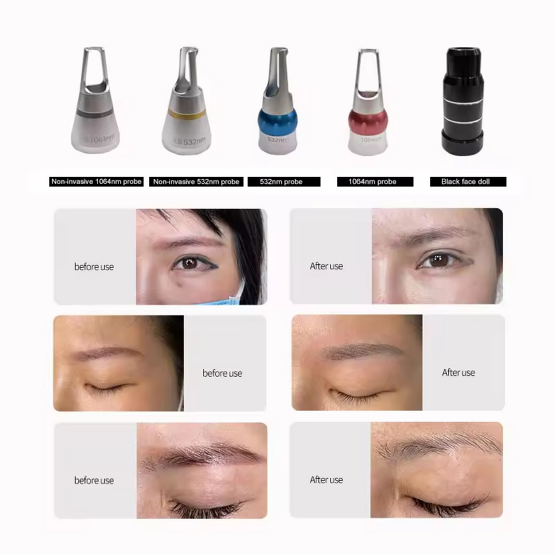 Picosecond Laser Machine - High-power Portable Eyebrow Tattoo Freckle Removal Instrument