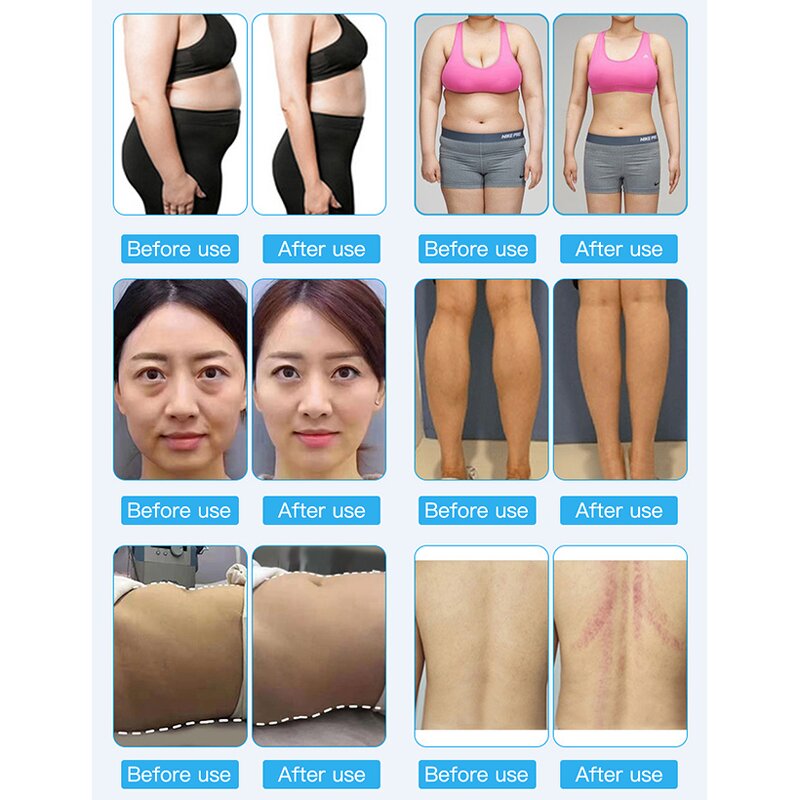 9 in 1 Slimming Machine - Hot Sale RF Vacuum 40k Cavitation Laser Fat Reduce System