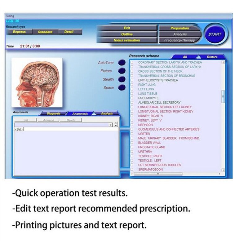 3D NLS Quantum Analyzer - 2023 Hot Sale Bio Resonance Magnetic Body Health Machine