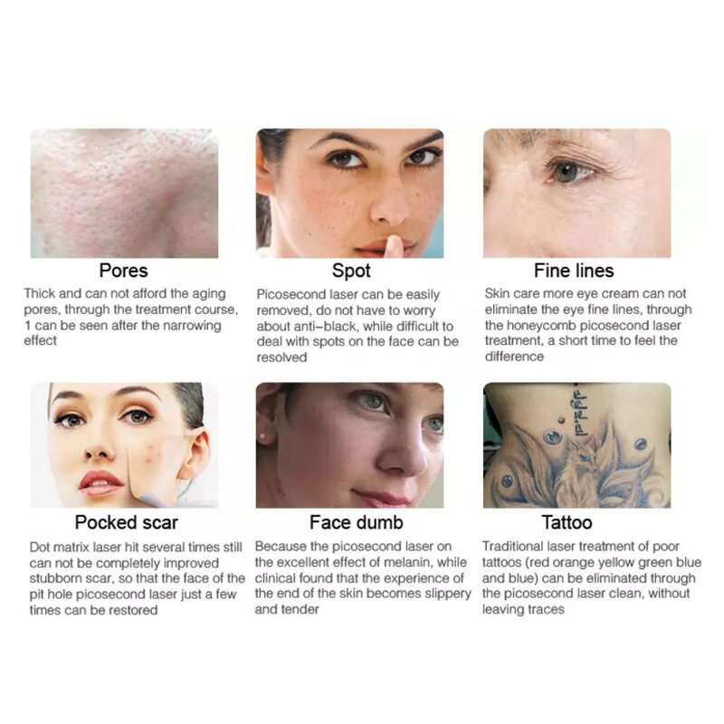 Carbon Peeling Laser - 2025 Best Selling Picosecond Nd Yag Skin Whitening Machine