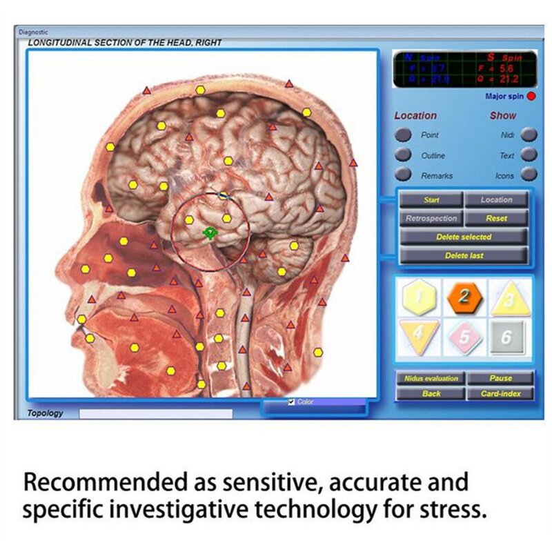 3D NLS Quantum Analyzer - 2023 Hot Sale Bio Resonance Magnetic Body Health Machine