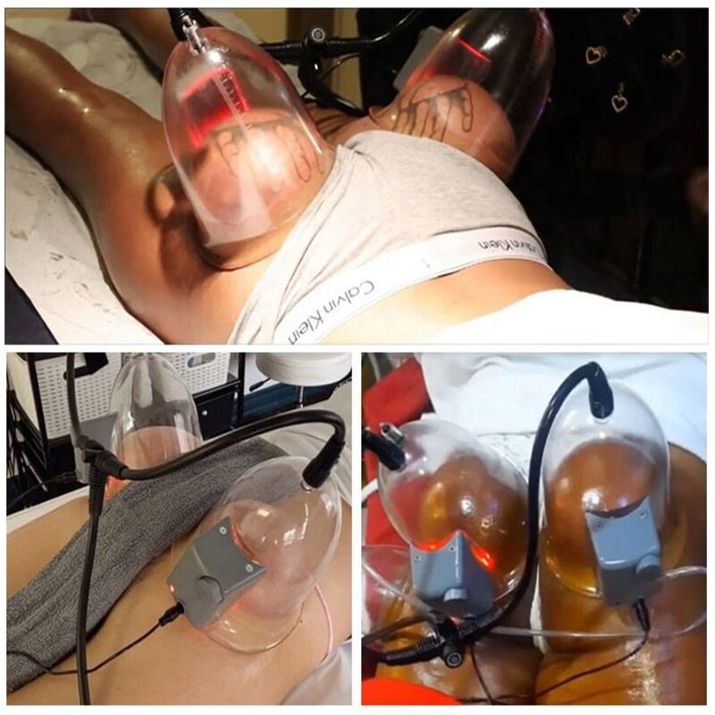 Vacuum Therapy Machine - 2023 Hot Sale Buttock Breast Enhancement Lifting Machine