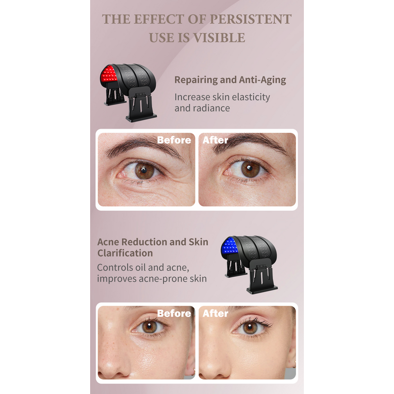 LED Spectrometer Beauty Machine Manufacturer - Home Whitening Anti-Wrinkle Flexible Multi-Function Therapy