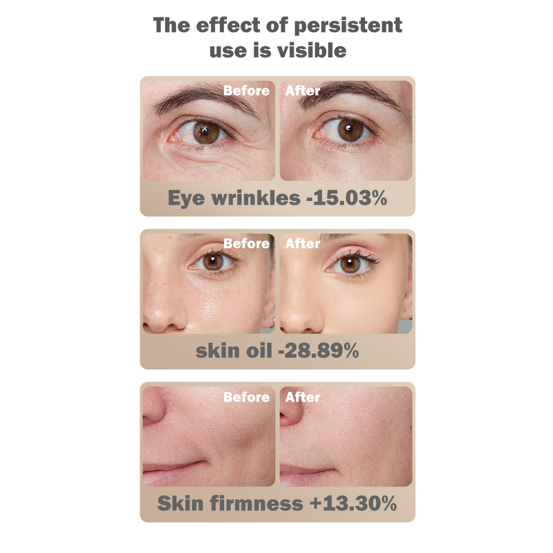 PDT Phototherapy Machine Manufacturer - 7 Color LED Wireless for Tender Skin