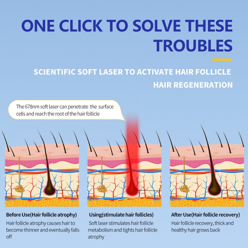 Hair Regrowth Cap Manufacturer - Wireless 272 LEDs Portable Home Use for Thinning Hair Alopecia