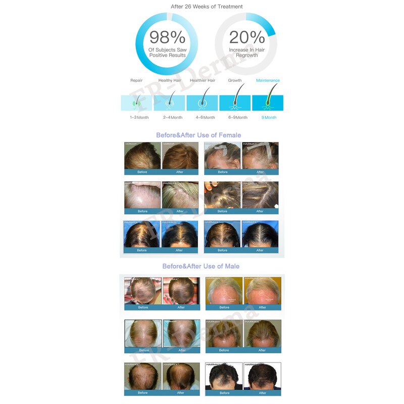 Red Light Hair Care Helmet Manufacturer - CE Approved for Home Hair Growth Treatments