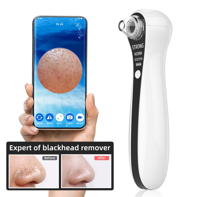 Blackhead Remover Kit - Electric Wireless Camera Facial Nose Pore Cleaning Tool