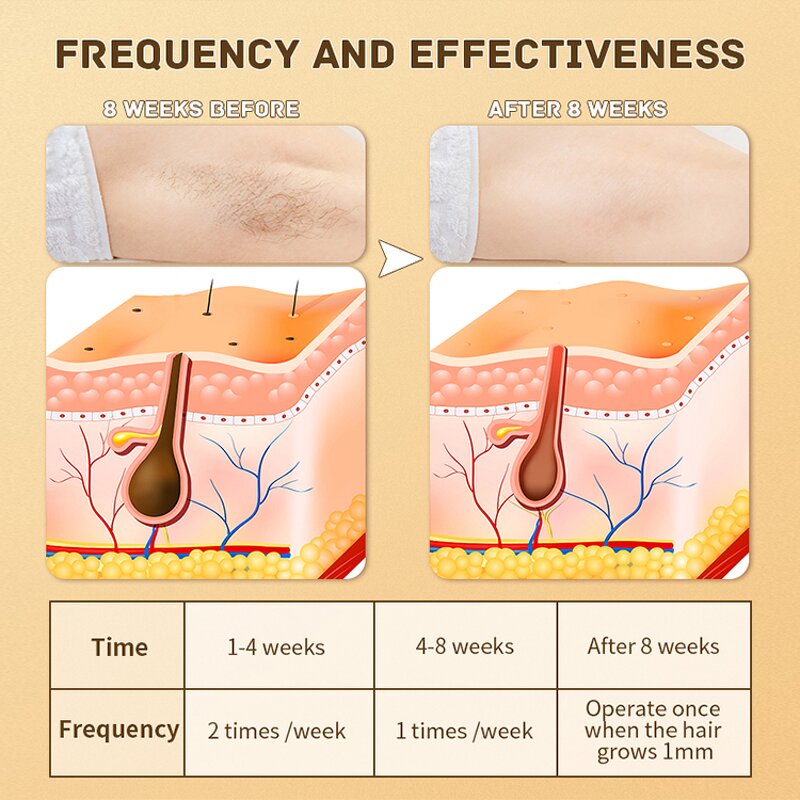 IPL Laser Hair Remover - 2026 Popular Home Use Facial Permanently Epilator Tool