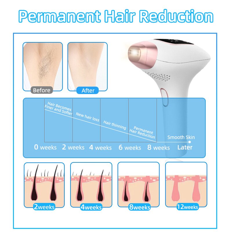 IPL Laser Hair Removal Device - New Lazer 9 Level Ice Cooling Permanent Handset