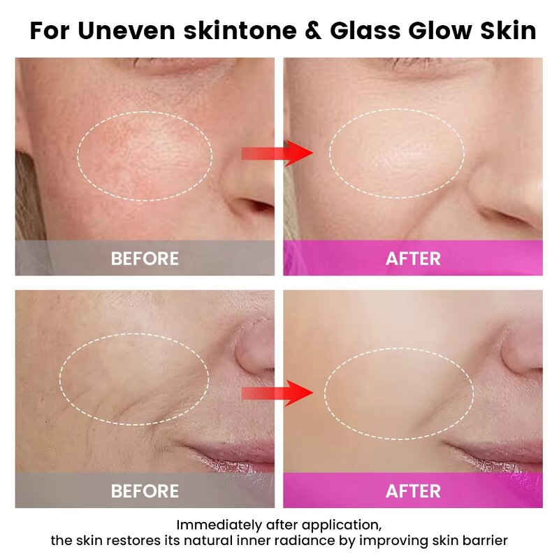 Facial Sculpting Wand - New Portable Anti Aging Wrinkle Remover Face Neck Tool