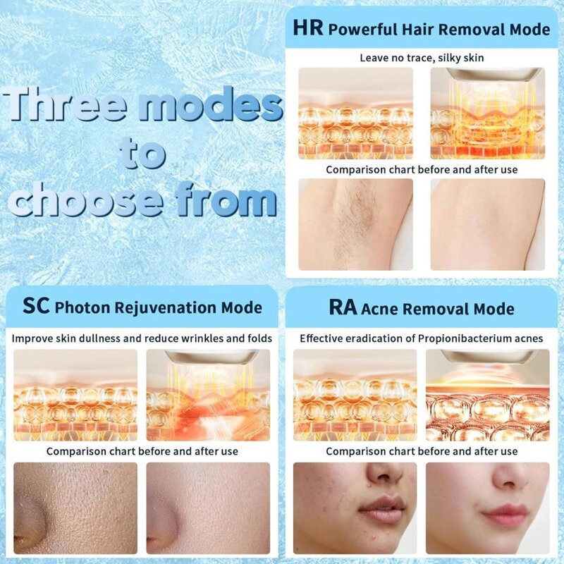 IPL Laser Epilator - Best Home Use Portable Ice Cooling Permanent Hair Remover