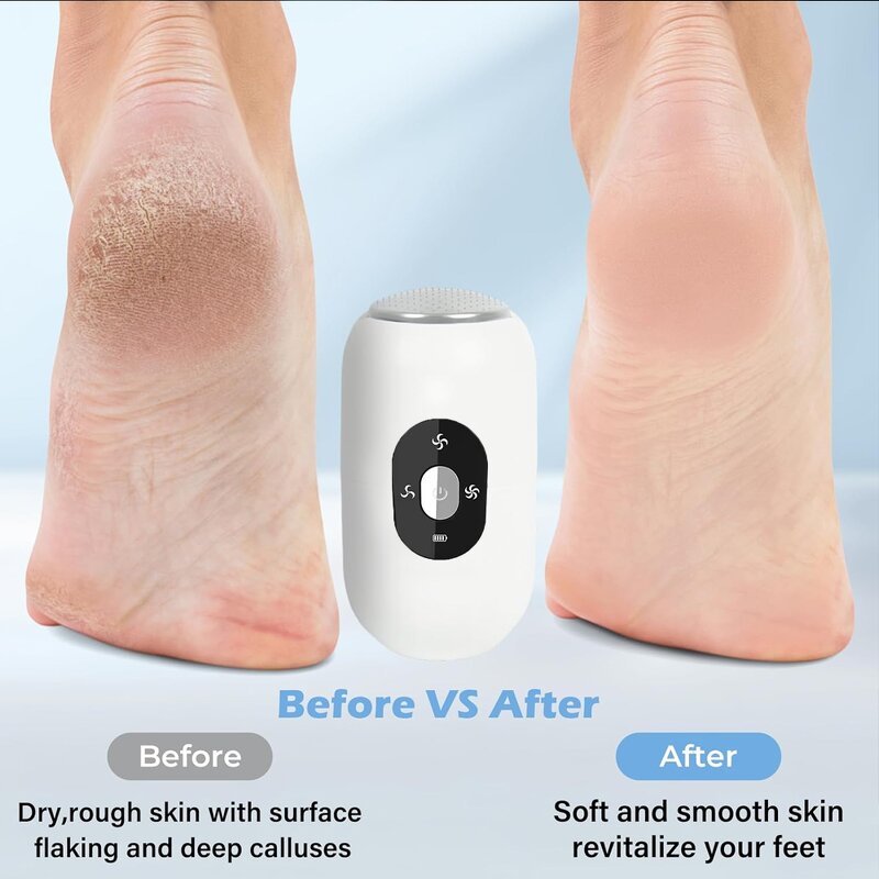 Electric Foot File - 2025 Hot Sale Callus Remover Rechargeable Foot Scrubber