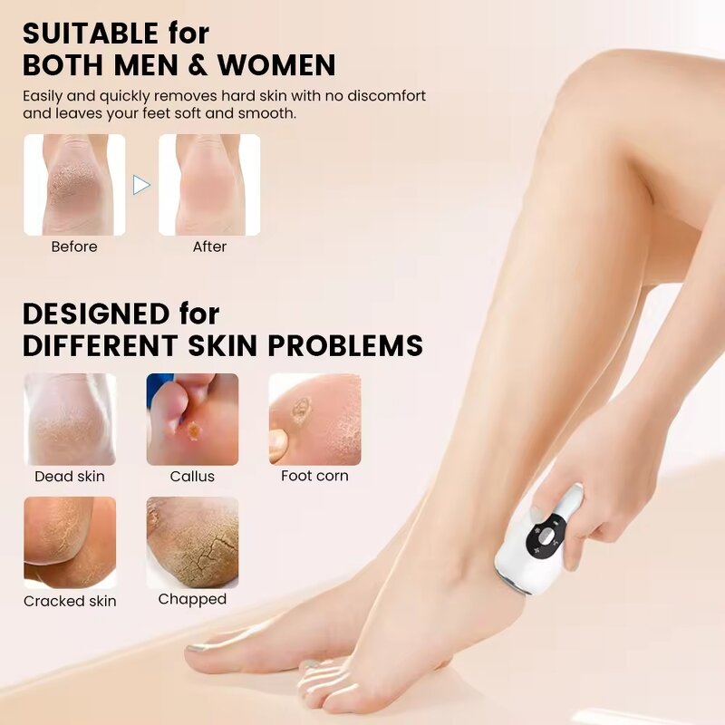 Electric Foot File - 2025 Hot Sale Callus Remover Rechargeable Foot Scrubber