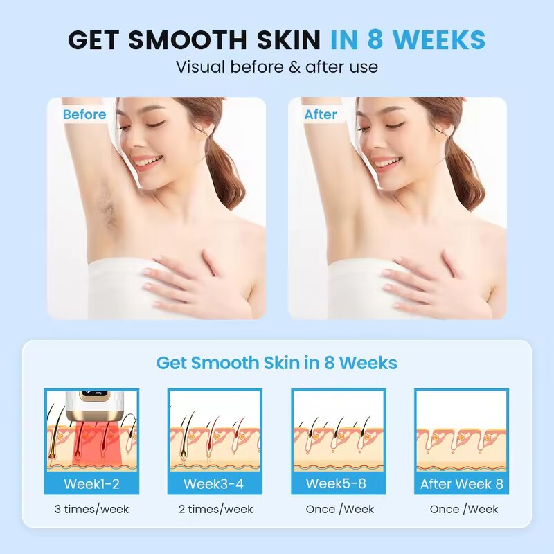 Mini IPL Hair Removal Device - Best Seller Women Ice Cooling Home Laser Handset