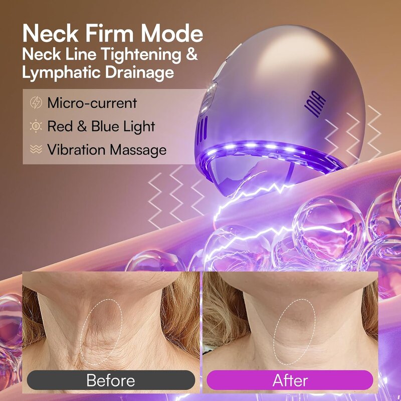 Derma Roller System - Custom 540 0.5mm Titanium Beard Hair Face Skin Care Tool