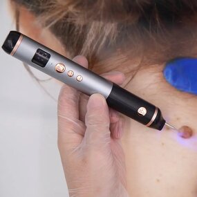 Electric Microneedling Derma Pen - OEM 12 24 36 PINS Home Salon Whitening Tool