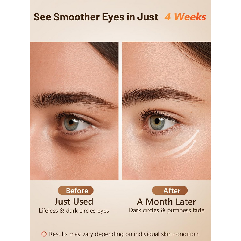 CryoPad Slimming Machine - Handheld Blue LED Fat Burning Belly Leg Weight Loss