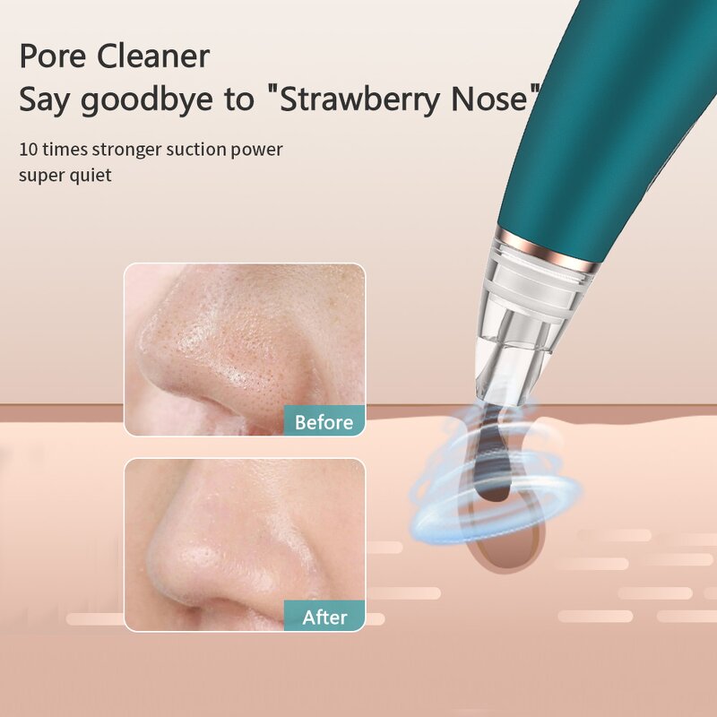 Electric Blackhead Remover - Dropshipping Vacuum Suction Pore Cleaner Acne Kit
