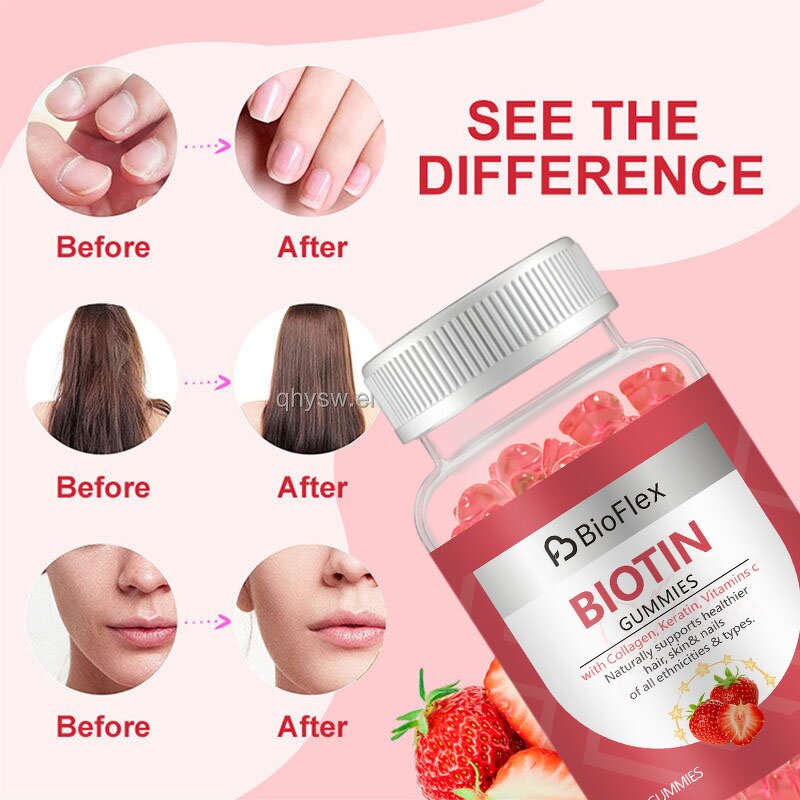 Biotin Collagen Gummies - OEM Multivitamin Keratin Hair Skin Nails Supplement