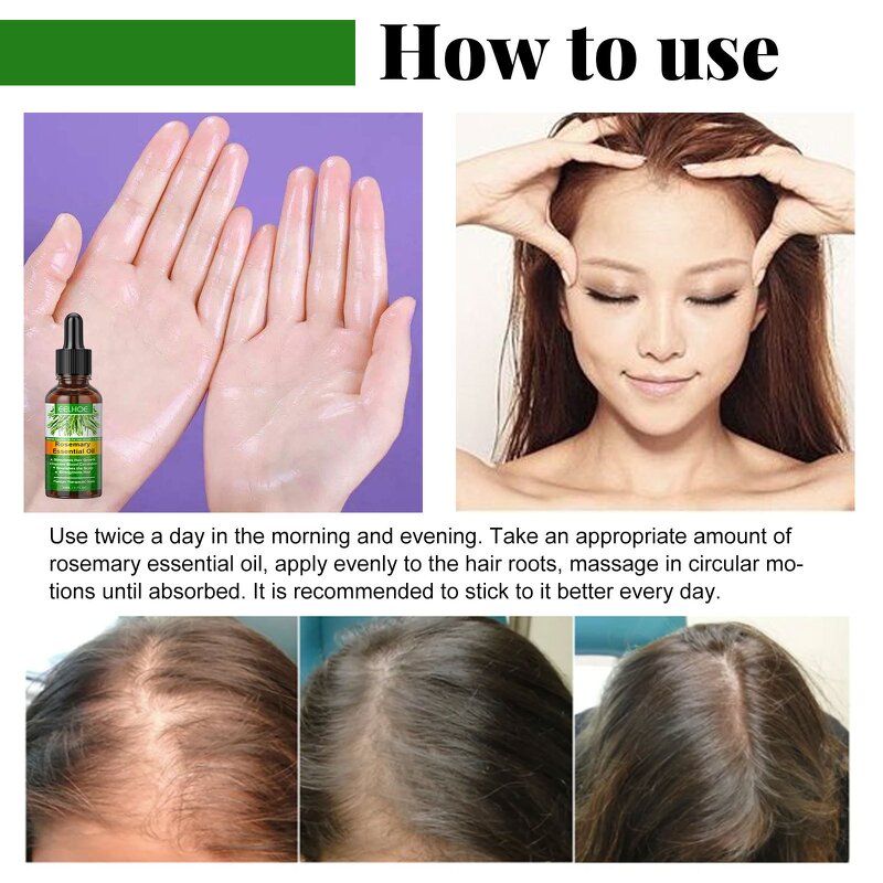 Rosemary Hair Oil - Eelhoe Herbal Infused Scalp Nourishing Anti-Hair Loss