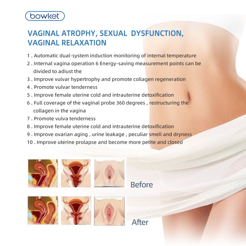 RF Skin Tightening Manufacturer - BOWKET Radio Frequency Women's Care US/EU Plug Skin Rejuvenation