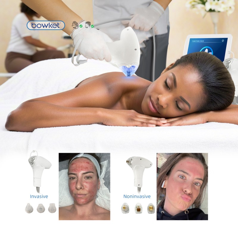 RF Beauty Equipment Manufacturer - BOWKET Mini for Facial Skin Tightening Wrinkle Removal Home Use