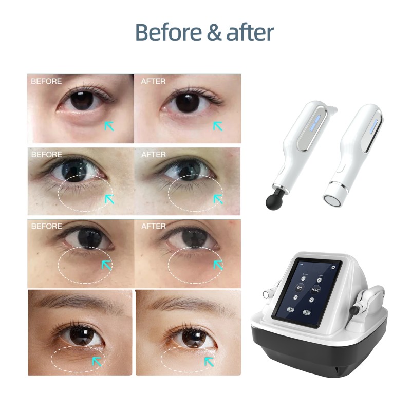 Professional RF Eye Massager Manufacturer - BOWKET Skin Care Radio Frequency for Eye Muscle Wrinkle Remover