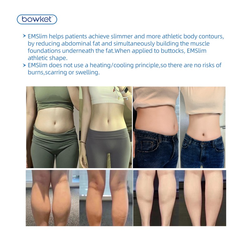 Portable EMS Machine Manufacturer - BOWKET Electromagnetic Muscle Stimulation Body Sculpting Weight Loss