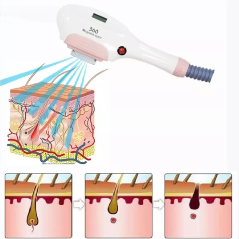 E-light IPL Machine Factory - 360 Magneto for Skin Rejuvenation Hair Removal Laser Machine