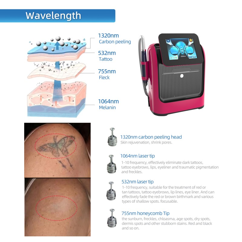 Tattoo Removal Machine Factory - BOWKET 755nm Beauty 1064nm Q-switch Nd Yag Laser