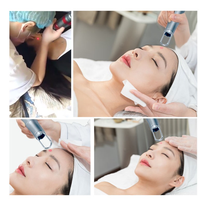 Picosecond Laser Manufacturer - BOWKET Portable 755nm 530nm 1064nm Tattoo Removal Beauty