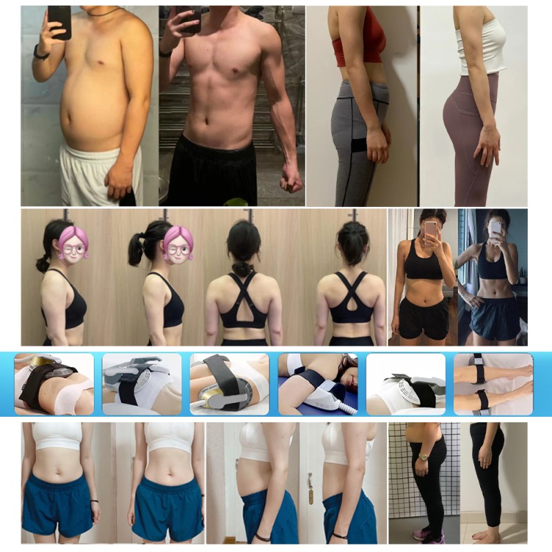 Portable EMS Machine Factory - Bowket RF Ems Slim Home Use ABS Skin Tightening Firming Whitening