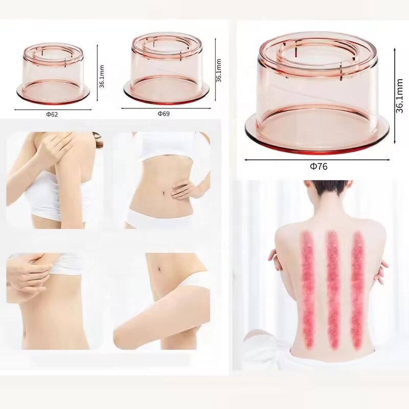 Electric Cupping Therapy Set Manufacturer - EBS9 Smart Bian-stone with Vacuum Red Light