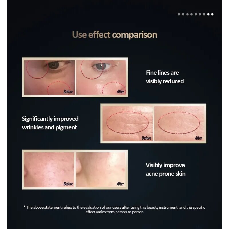 Skin Rejuvenation Device Manufacturer - Portable Electric Anti-Wrinkle Handheld Red Infrared Light Therapy