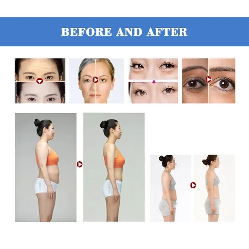 RF Beauty Device Manufacturer - Mini 2-in-1 Home Salon Use for Facial Skin Lifting Firming US EU