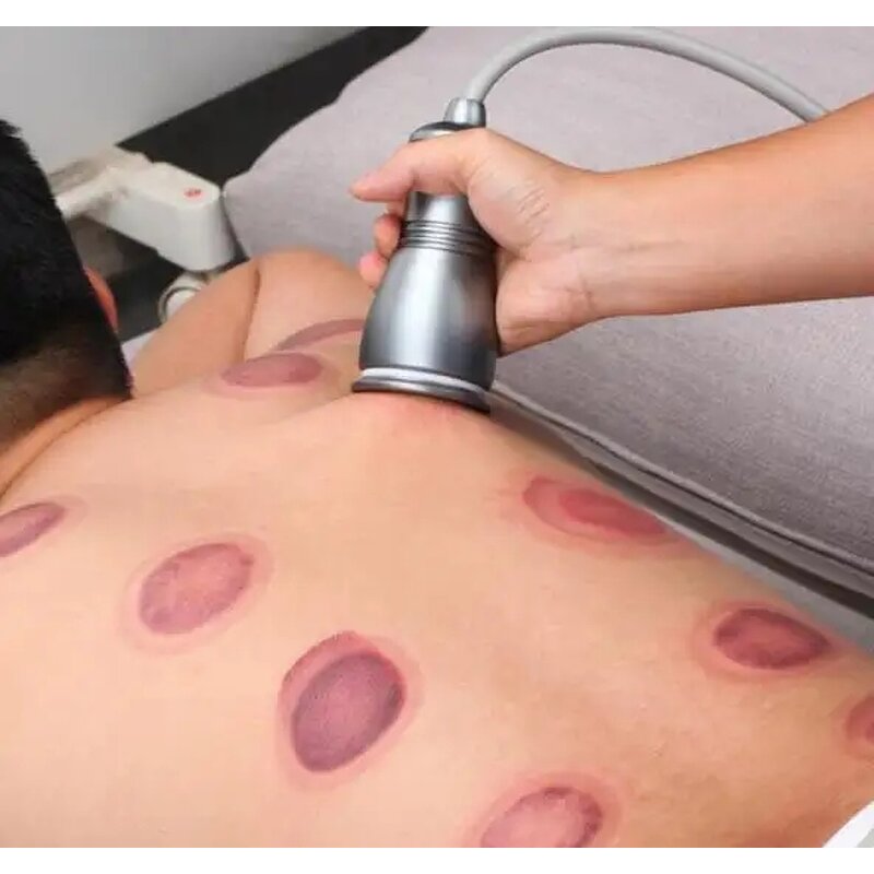 Body Slimming Instrument Manufacturer - Pain-Free Negative Pressure Heating Electric Cupping Scraping