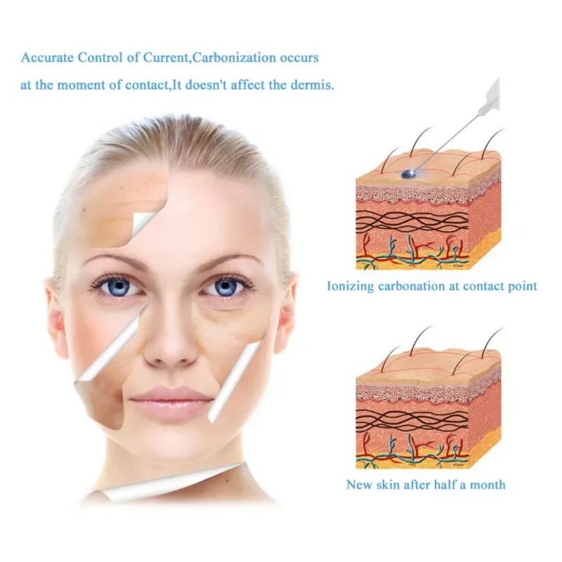 Plasma Pen Manufacturer - New Arrival Home Use for Eye Face Lifting & Mole Wart Removal