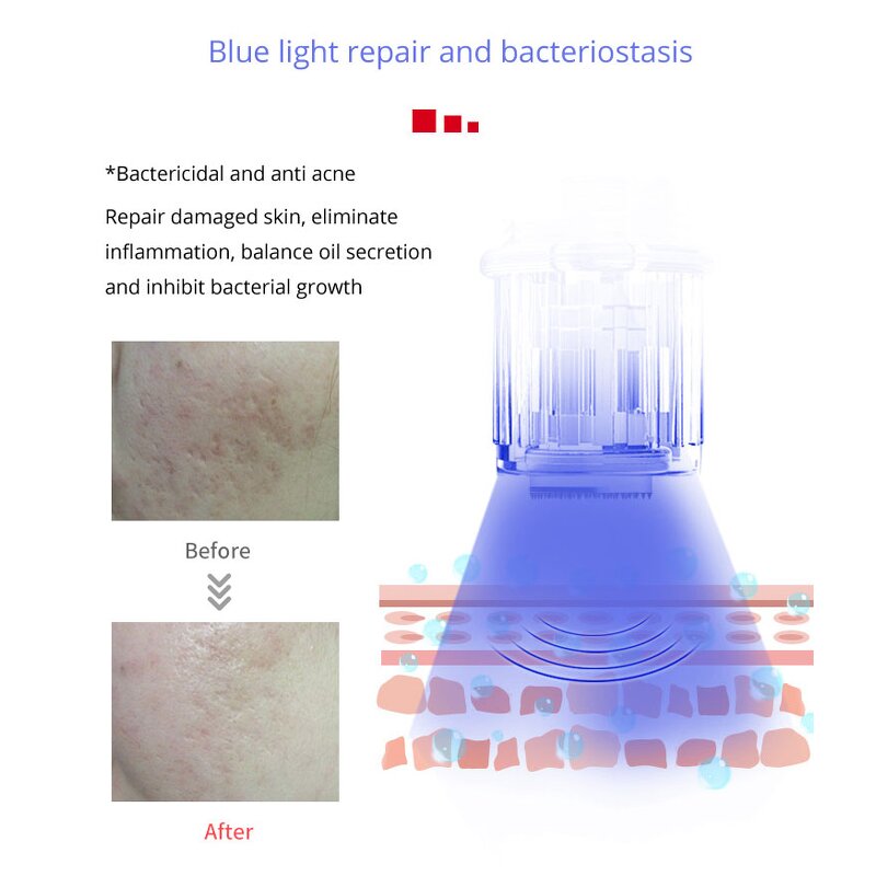 Derma Pen Needles Manufacturer - Professional with LED Light Cartridge for Micro Needling