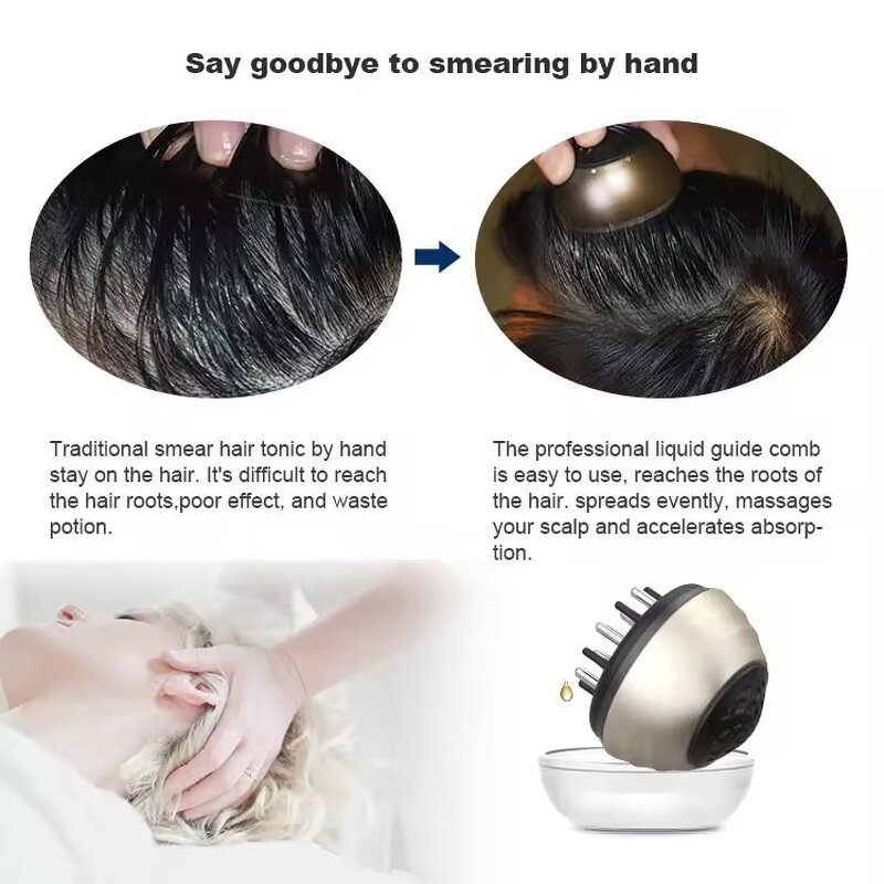 Scalp Massager Manufacturer - Hair-thinning Treatment with Massaging Brush for Scalp Care