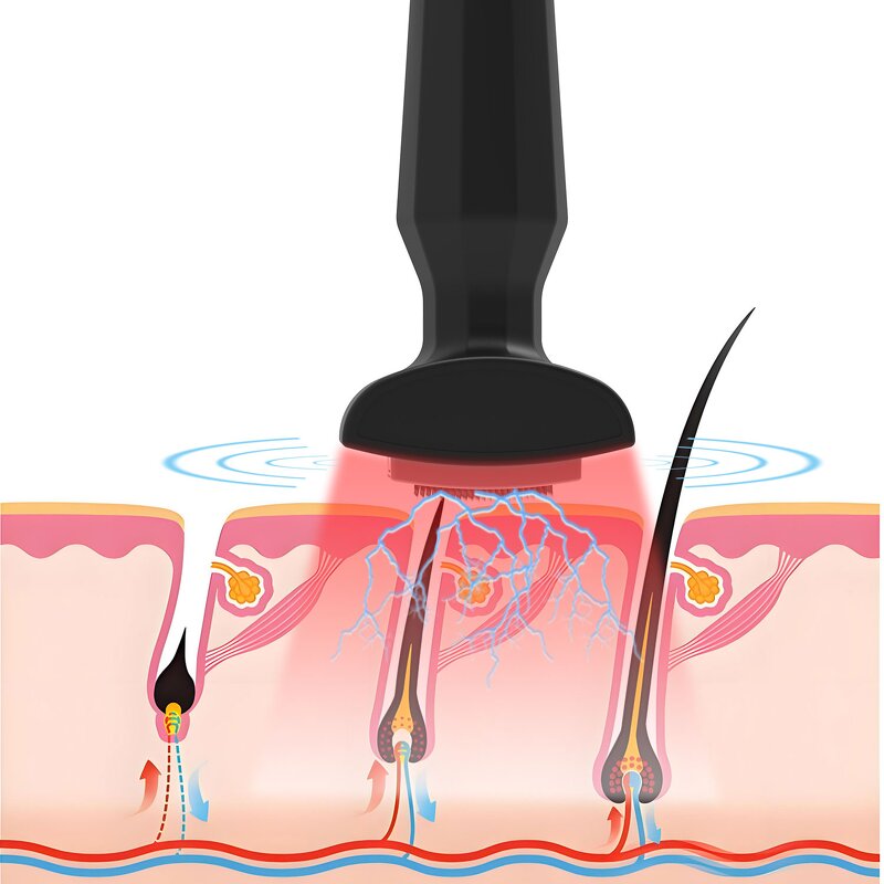 Scalp Massager Manufacturer - Red Light Microcurrent 4-in-1 Portable for Home & Salon