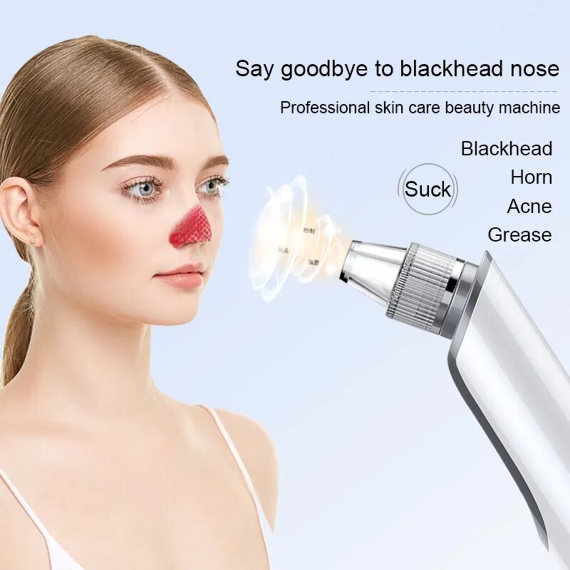 Blackhead Remover Device Manufacturer - Wholesale Price Vacuum for Deep Pore Cleaning